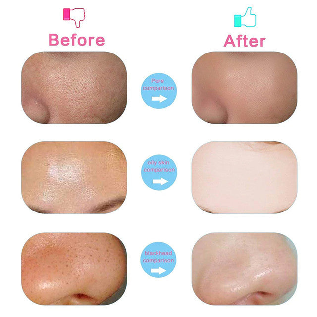 Facial Electric Cleanser And Massager, Beauty Care Brush For Removing Blackhead